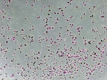 MSC adhesion 20 min