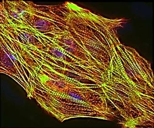 Cardiac cells — TNNT2 / ACTN2 / DAPI