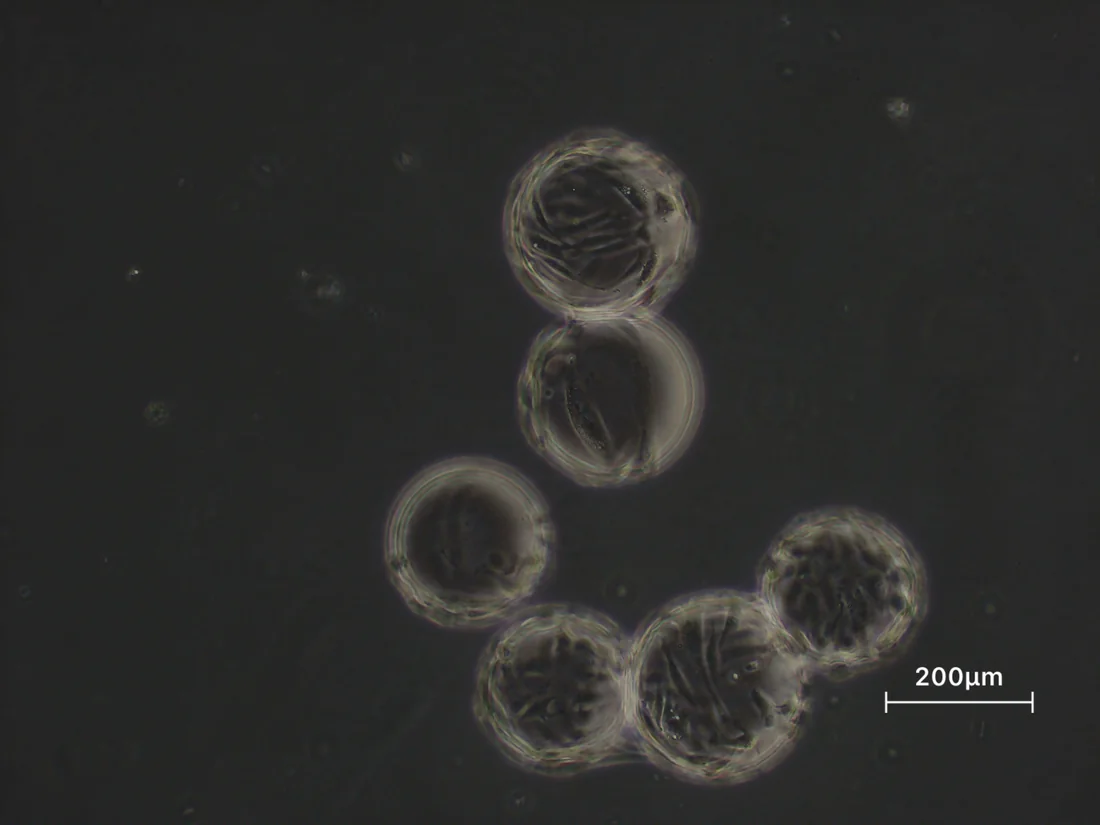 Microscopy of cells cultured on microcarriers