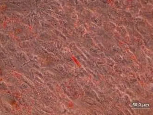 AllPhase diff Differentiated Adipogenesis