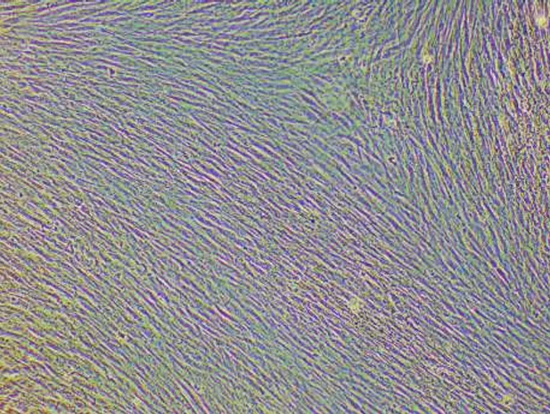 Control Chondrogenesis