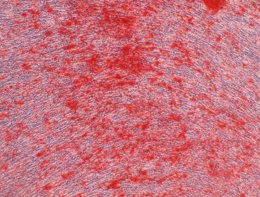 AllPhase diff Differentiated Osteogenesis
