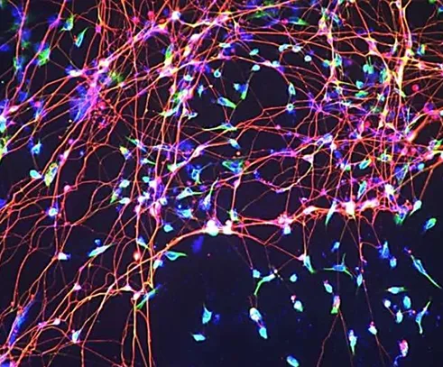 Neural cells — Tuj-1 / Nestin / DAPI