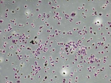 MSC adhesion 40 min