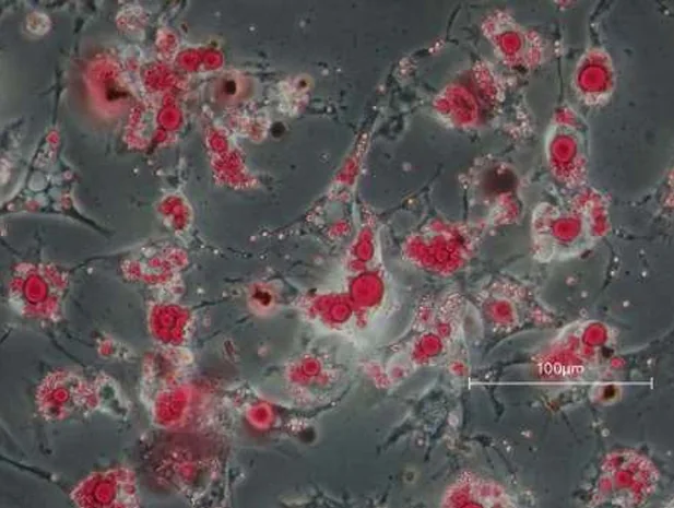 Differentiated Adipogenesis