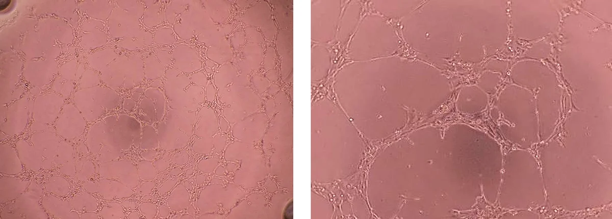 HUVEC Angiogenesis