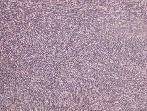AllPhase diff Control Osteogenesis