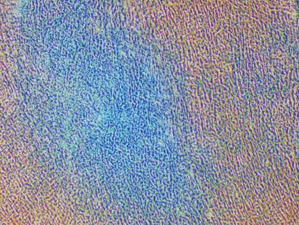 Differentiated Chondrogenesis
