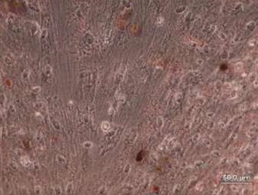 AllPhase diff Control Adipogenesis