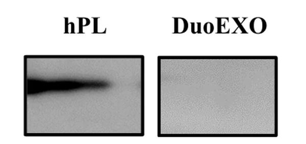 Western Blot medium only