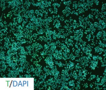 Mesoderm