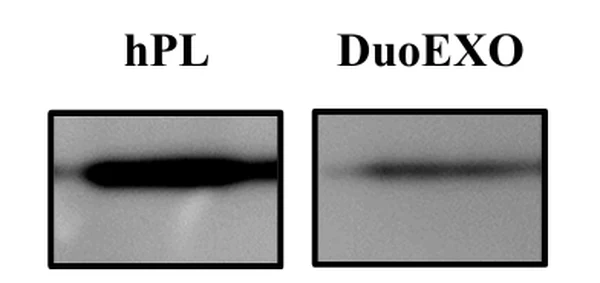 Western Blot after MSC culture